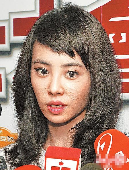 蔡依林就医抢救烂痘脸 疑与爱犬亲密惹祸
